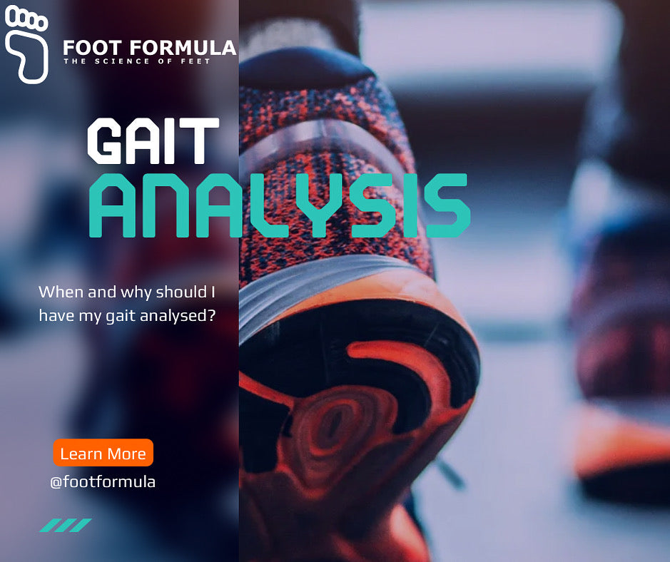 Understanding Gait Analysis: Why It’s Not Just for Athletes